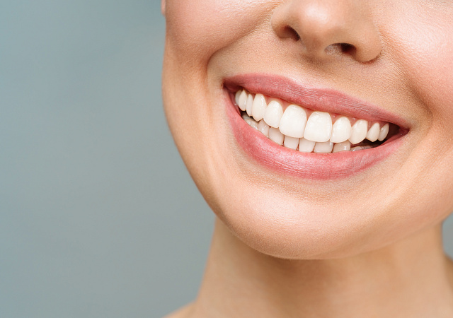 A Smile After the All on 4 Dental Implant Restoration Dental Treatment.