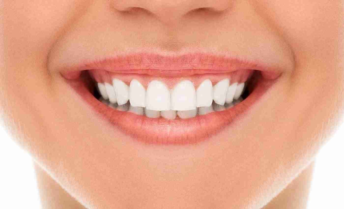 A Woman Getting Dental Mini Implants for Her Teeth Replacement