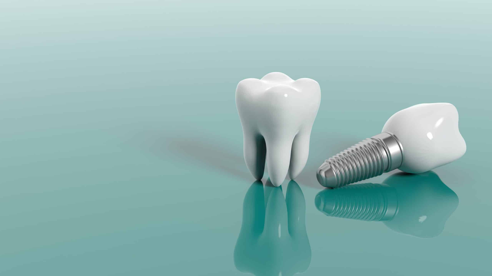 An Implant and a Model of a Real Tooth Sitting in Comparison