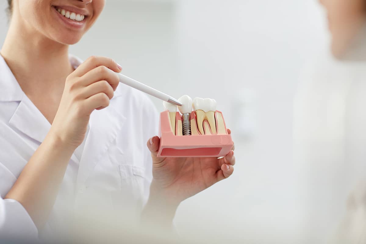 A Dentist Showing How Our Implants (Dental) Near You Can Change Your Life