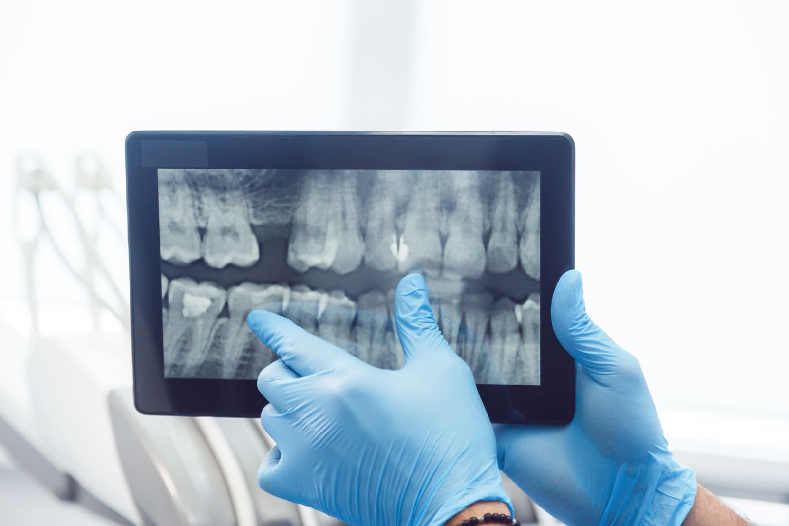 Best Digital Dental X-rays in Mercer Island