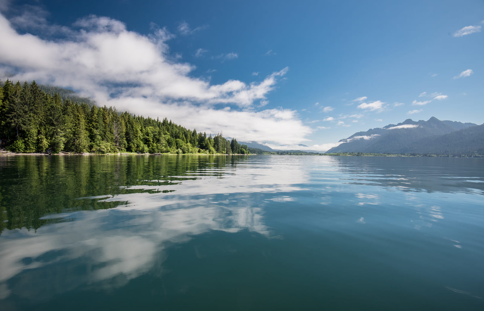 Fluoride Treatment In Mercer Island