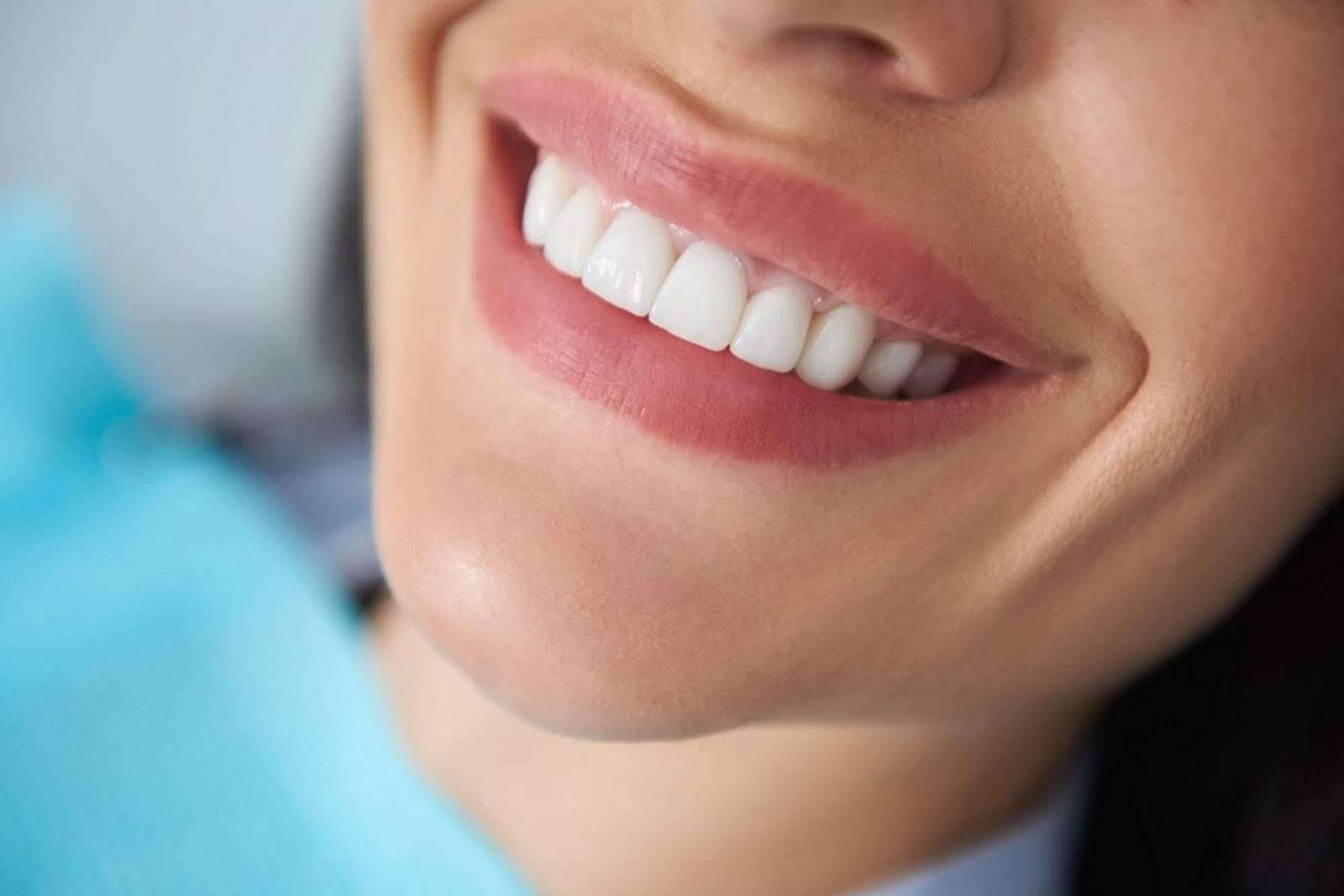 Close-up of a bright, healthy smile showcasing the results of dental bonding, tooth fillings, and teeth bonding treatments for a natural appearance.
