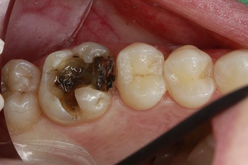 actual patient before dental procedure