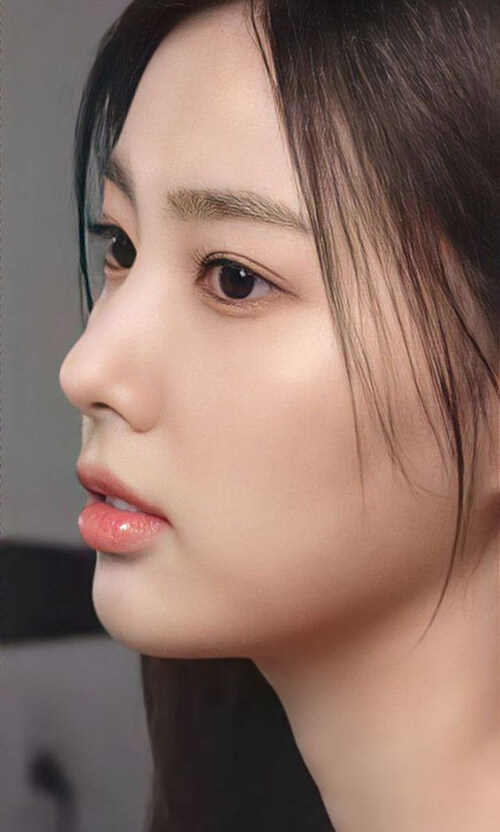 Mũi dáng S Line cao tây