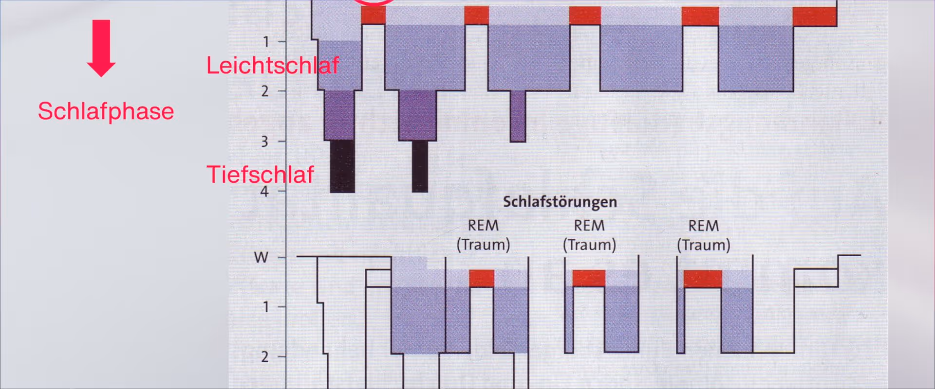 Zahnärztliche Schlafmedizin - Warum das Thema Schlaf uns jeden Tag in der Praxis begegnet