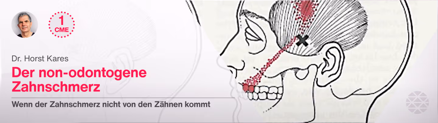 Der non-odontogene Zahnschmerz
