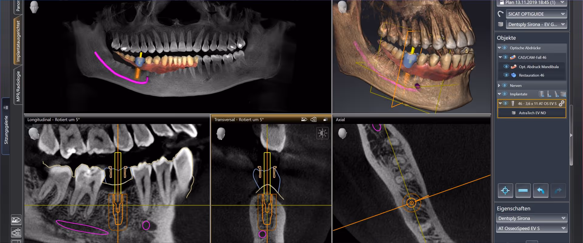 Einführung in die Dentale Volumentomographie für die ZFA und ZMF
