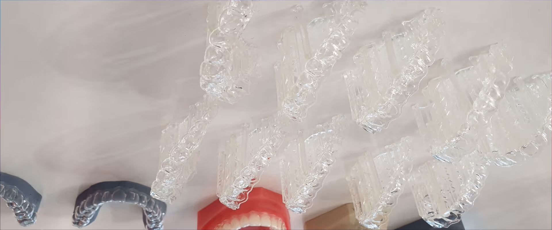 3D-Druck in der dentalen Welt