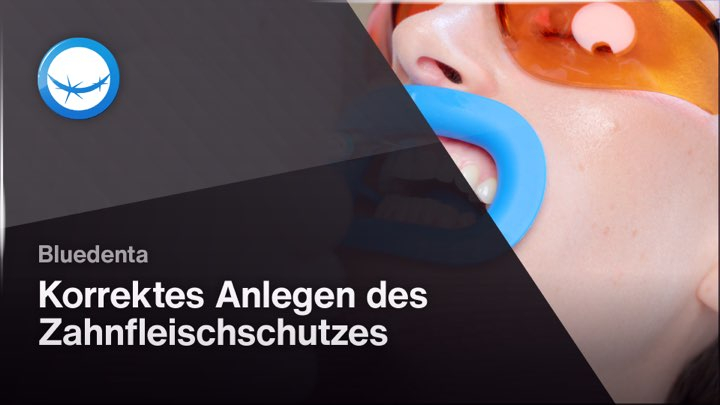 Korrektes Anlegen des Zahnfleischschutzes