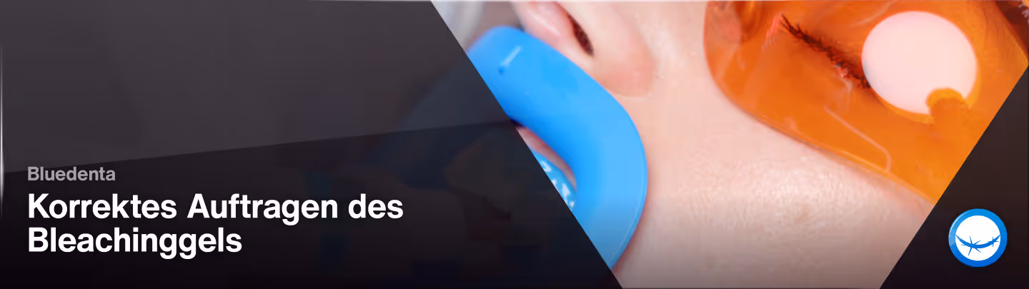 Korrektes Auftragen des Bleachinggels