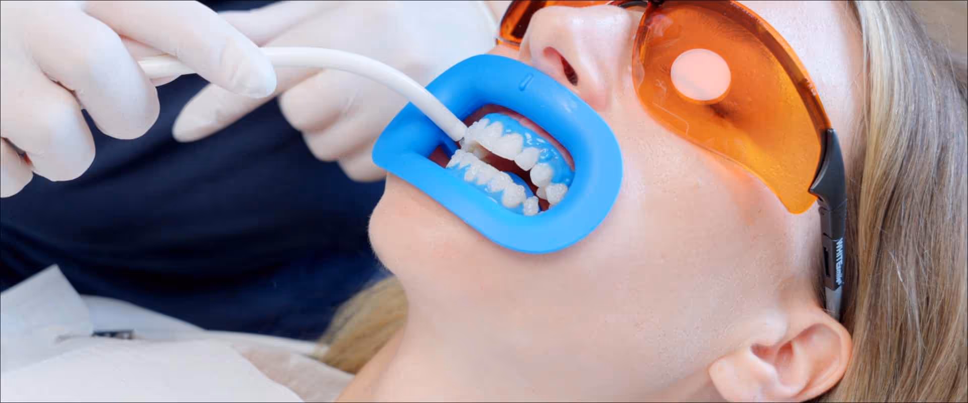 Zwischen den Bleaching-Zyklen