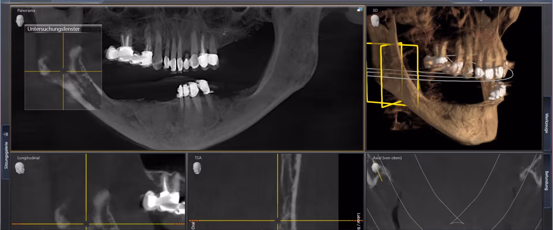 Digitale Planung und Diagnostik