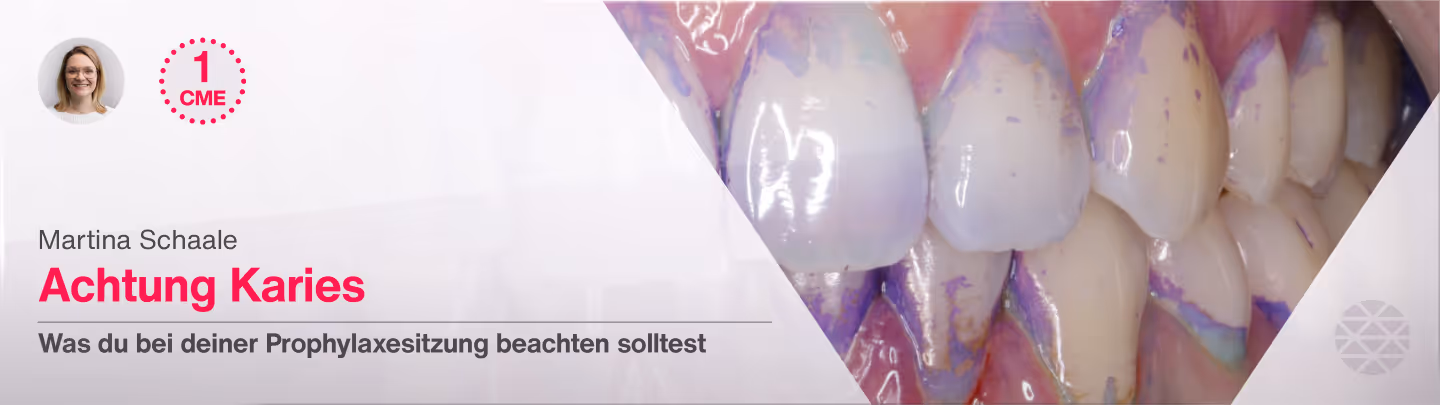 Achtung Karies