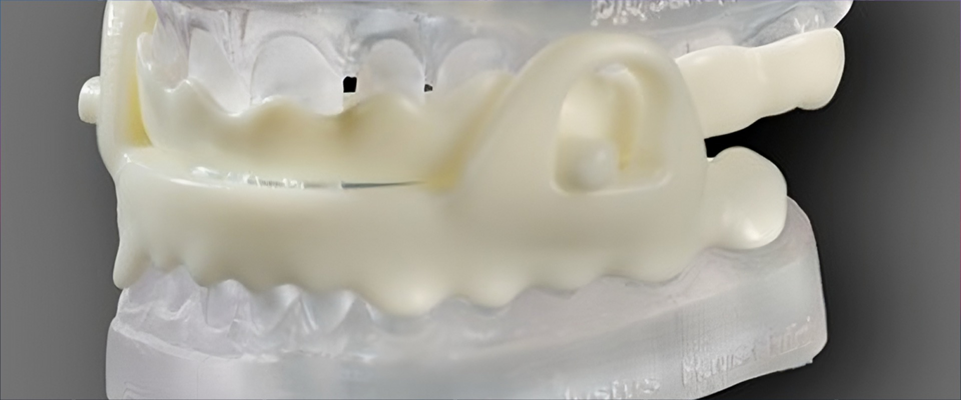 Die Unterkieferprotrusionsschiene