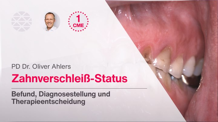 Zahnverschleiß-Status