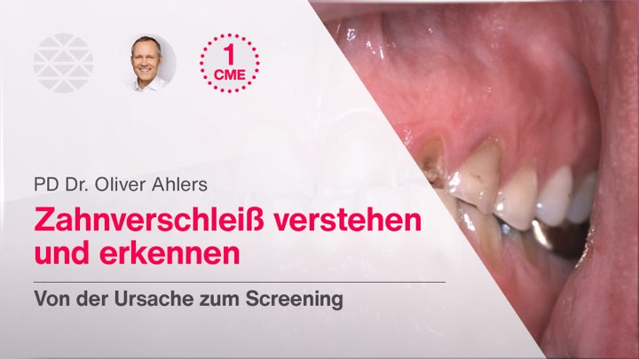 Zahnverschleiß verstehen und erkennen