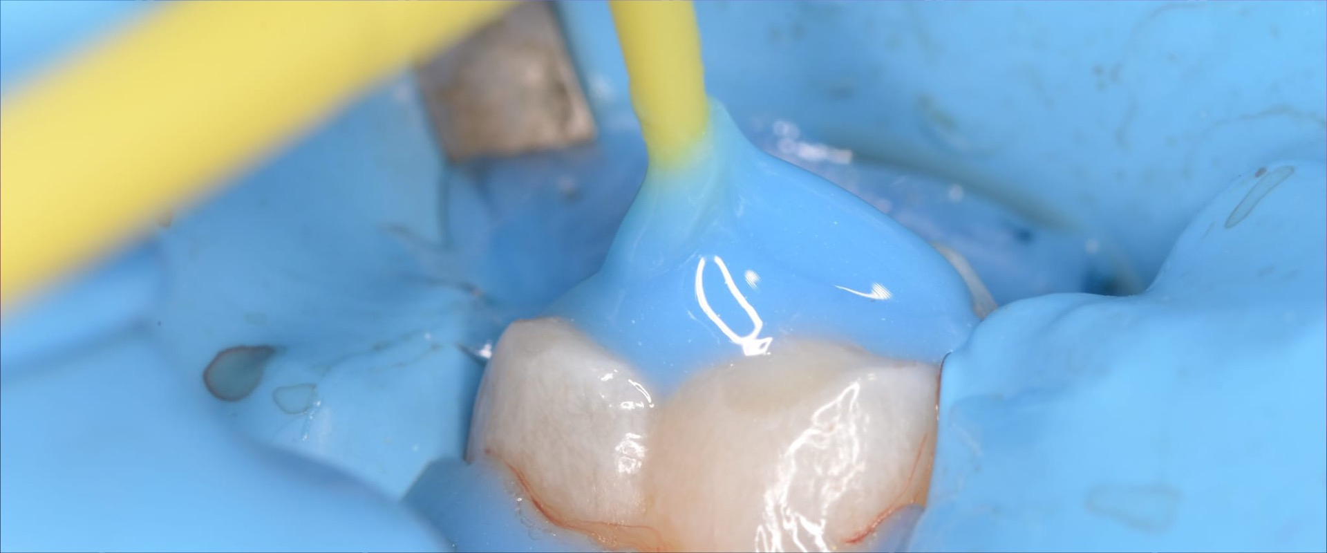 Komposit Stempeltechnik