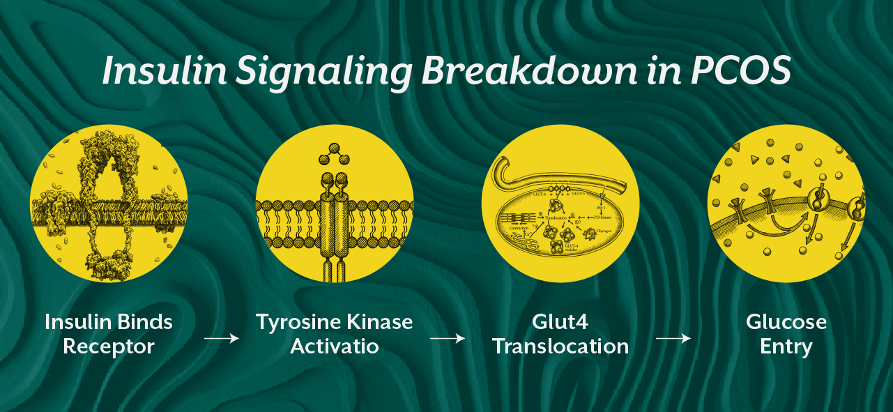 Insulin Signaling Breakdown in PCOS