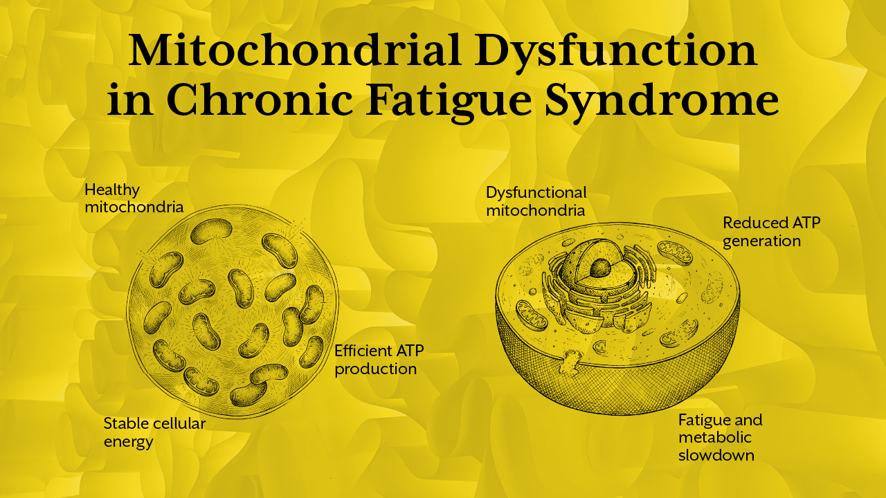 Mitochondrial Dysfunction in Chronic Fatigue Syndrome