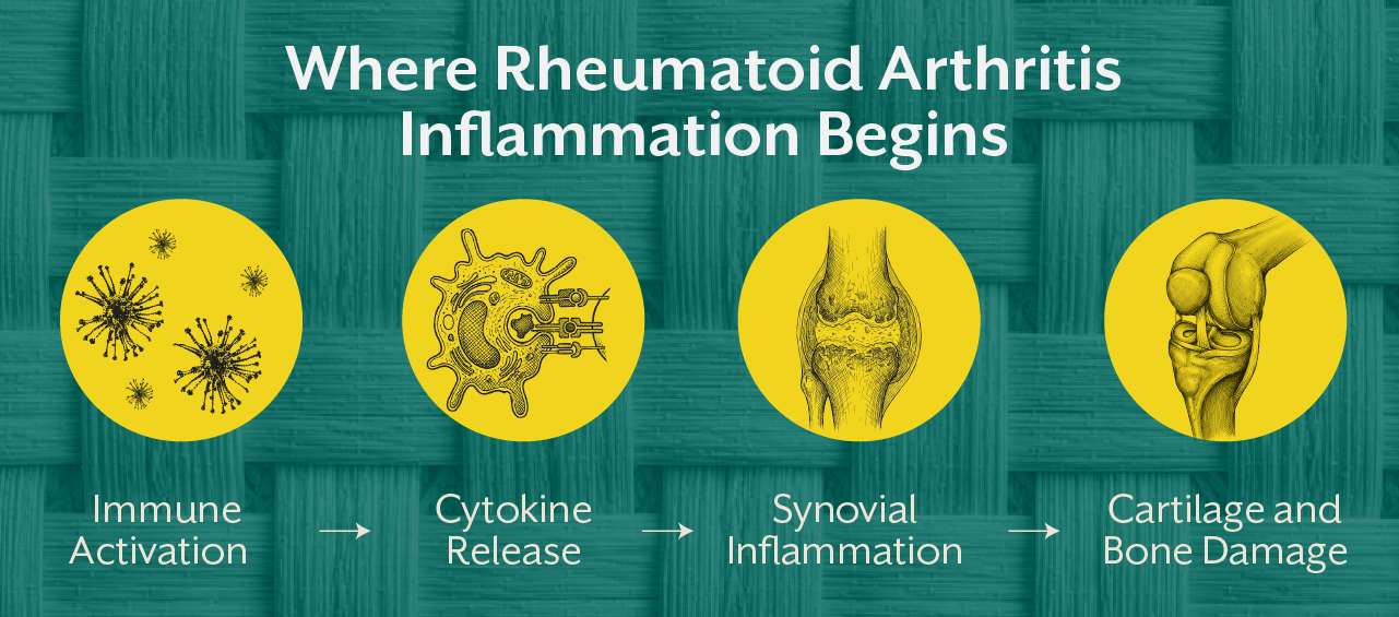 Where Rheumatoid Arthritis Inflammation Begins