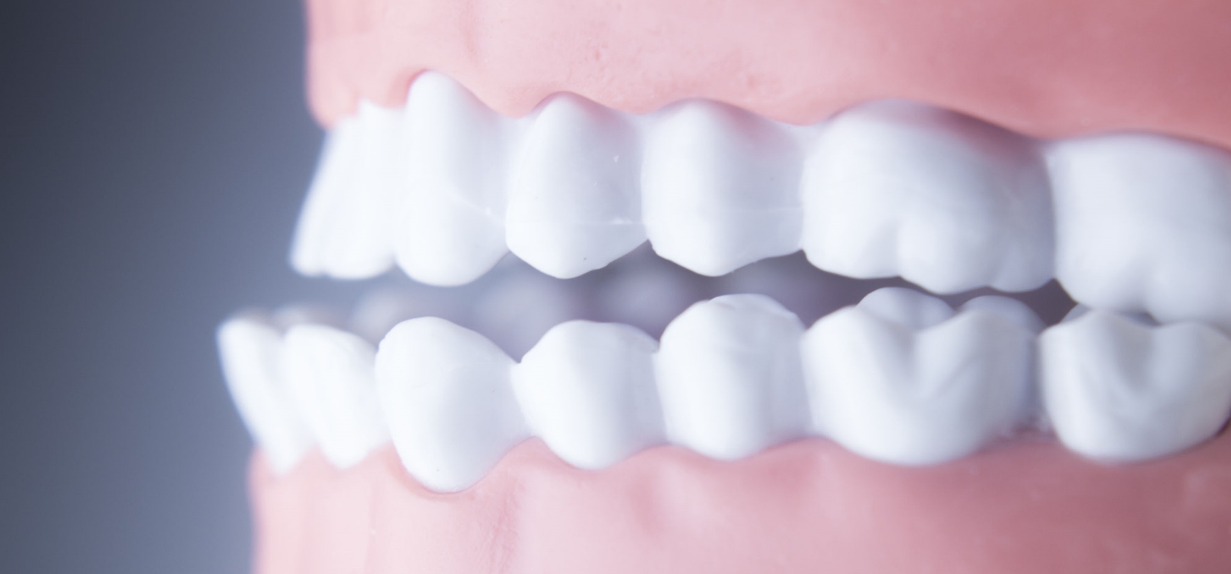 Eine Zahnfehlstellung kann schwerwiegende gesundheitliche Probleme verursachen.