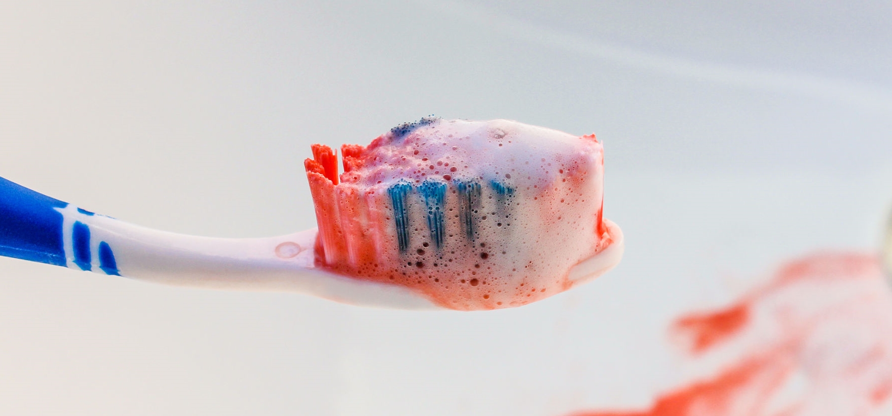 Blut an der Zahnbürste – eine Zahnfleischentzündung ist häufig die Ursache.