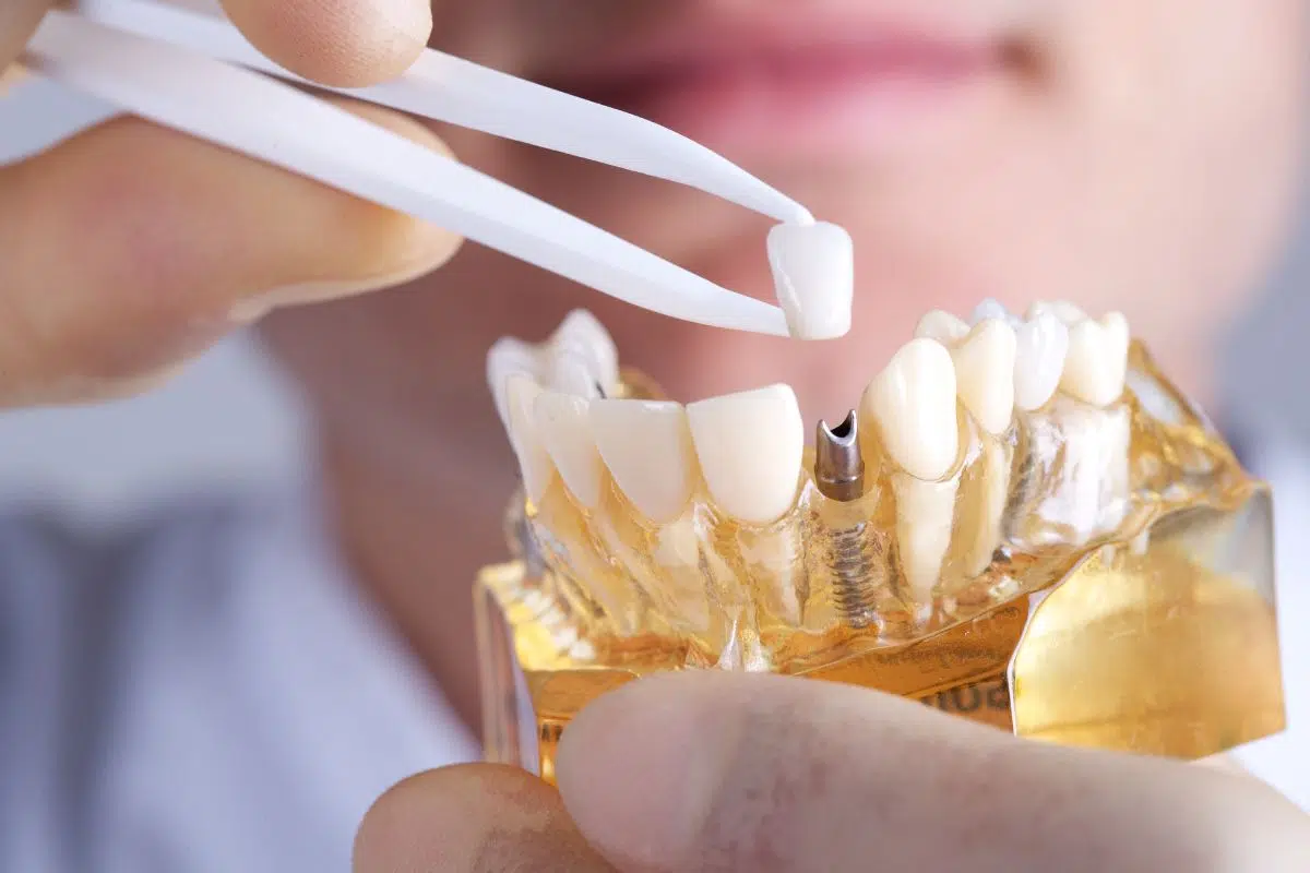 Why Biocompatible Materials Matter in Dentistry