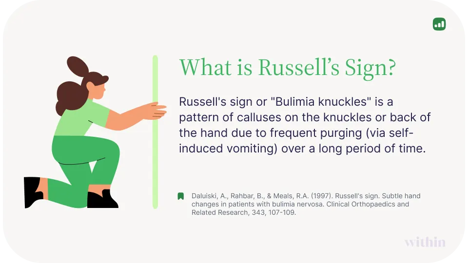Russell's Sign defined graphic