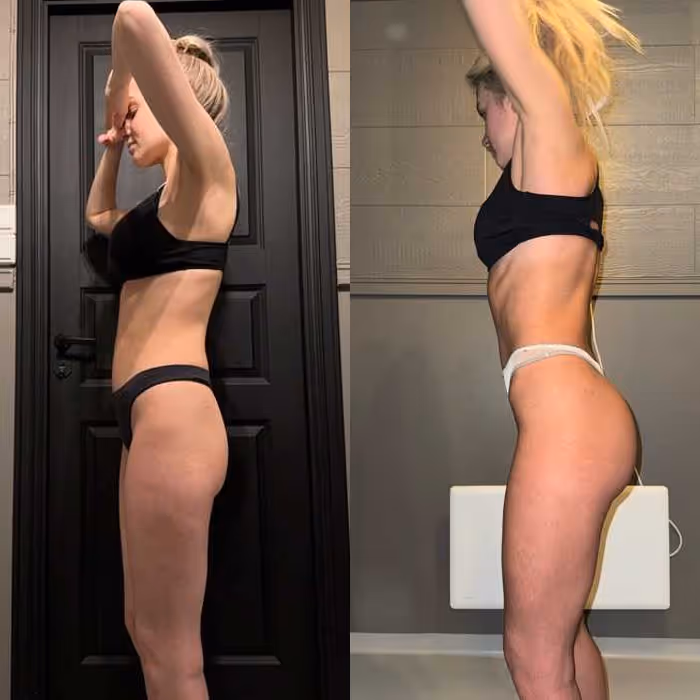 woman before and after photo