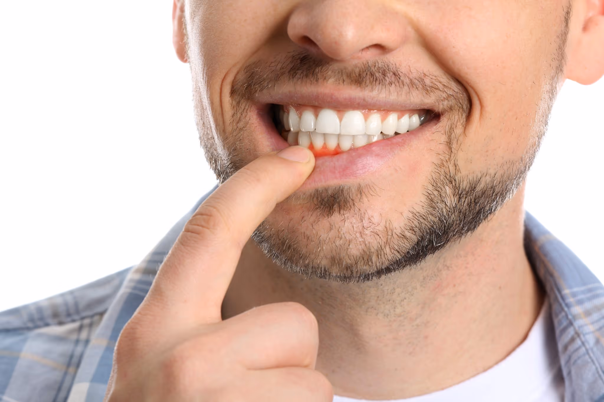 Foods that stain your teeth