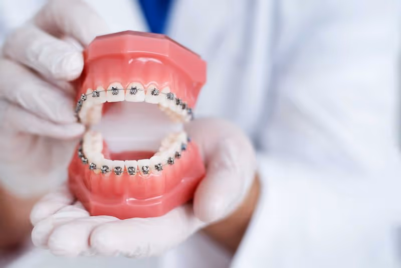 Embracing Change: The Ultimate Guide to Adult Braces by Brauer Family