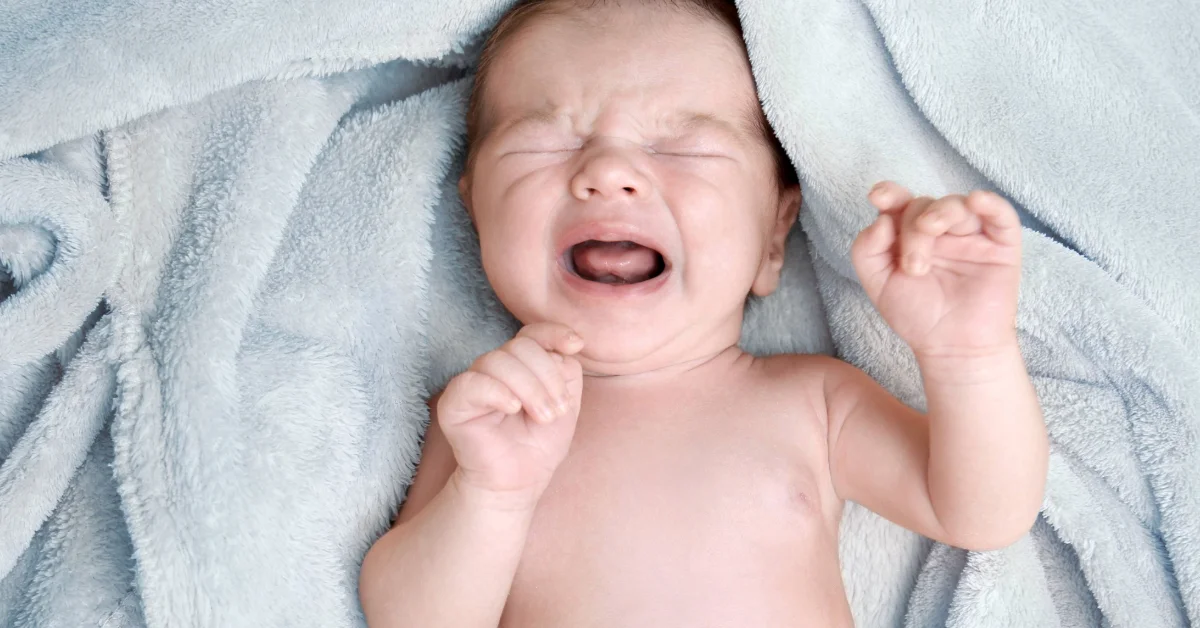 Crying baby lying on a blanket with arms raised, face showing distress — often used to represent infant discomfort such as colic or umbilical hernia symptoms.