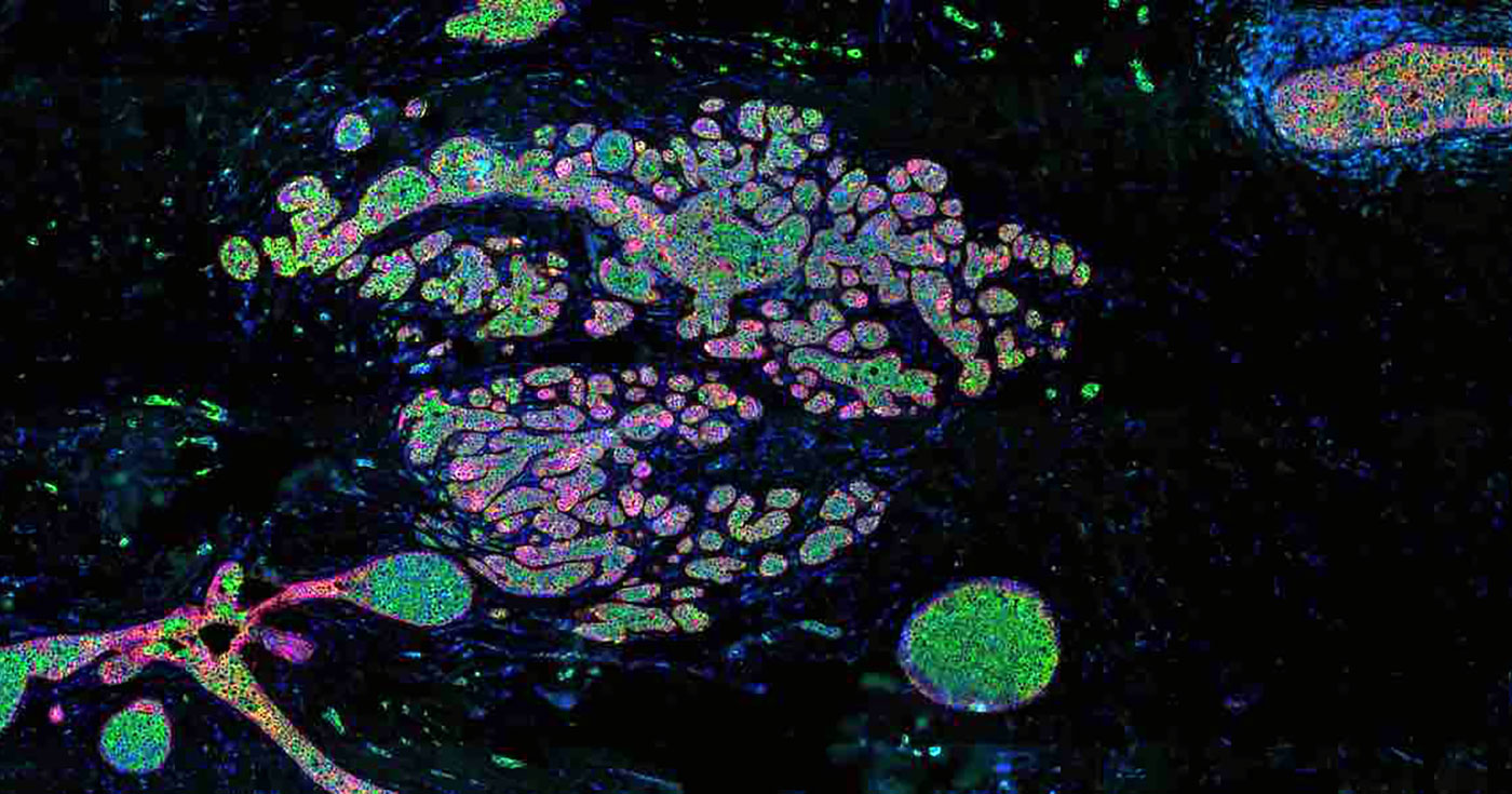 Spatial omics is transforming biology by revealing how molecules and cells interact within healthy and diseased tissues.