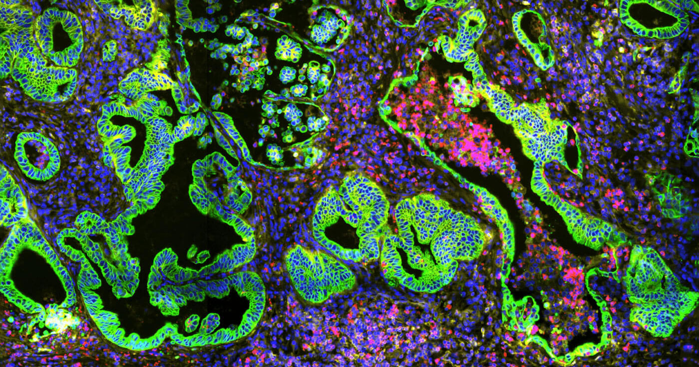 Owkin powers a new era in oncology research with MOSAIC