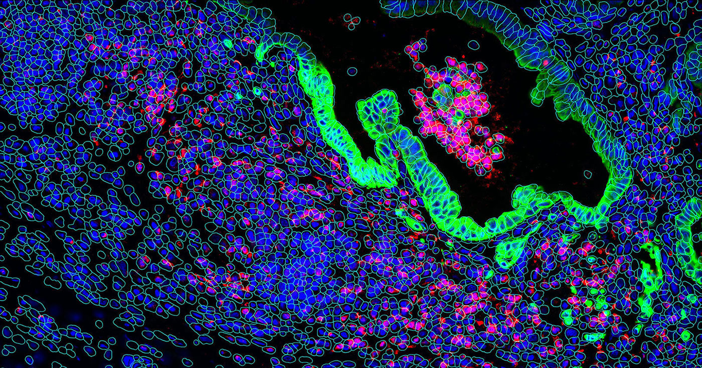 MOSAIC is launched to power a revolution in oncology research