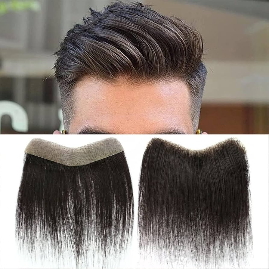 Hair systems for men