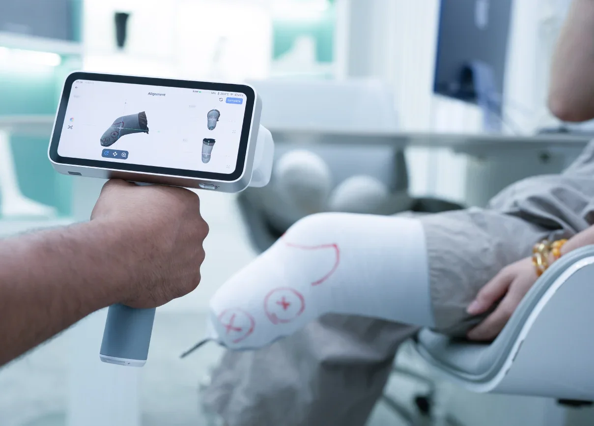 3D scanning a residual limb