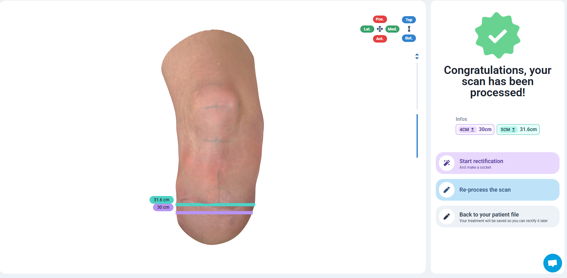 Automatic measurements at 4 and 5 cm