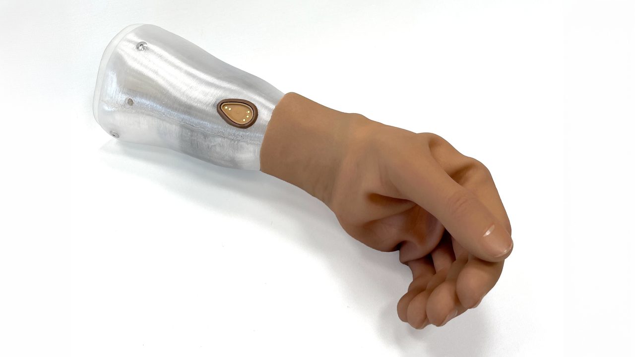 VYSTA upper limb check socket