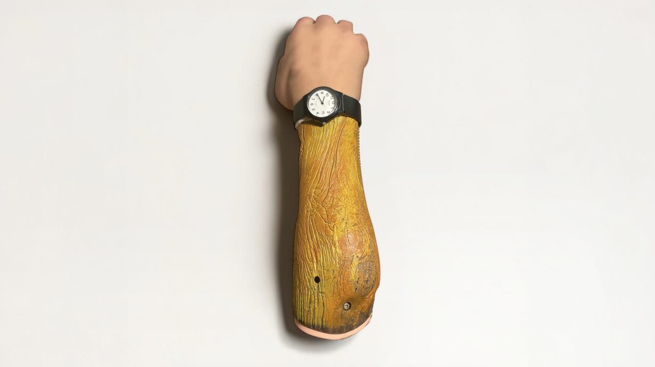 EVERvy upper limb definitive