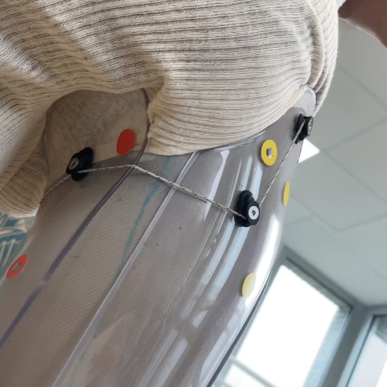 VTF weight-bearing