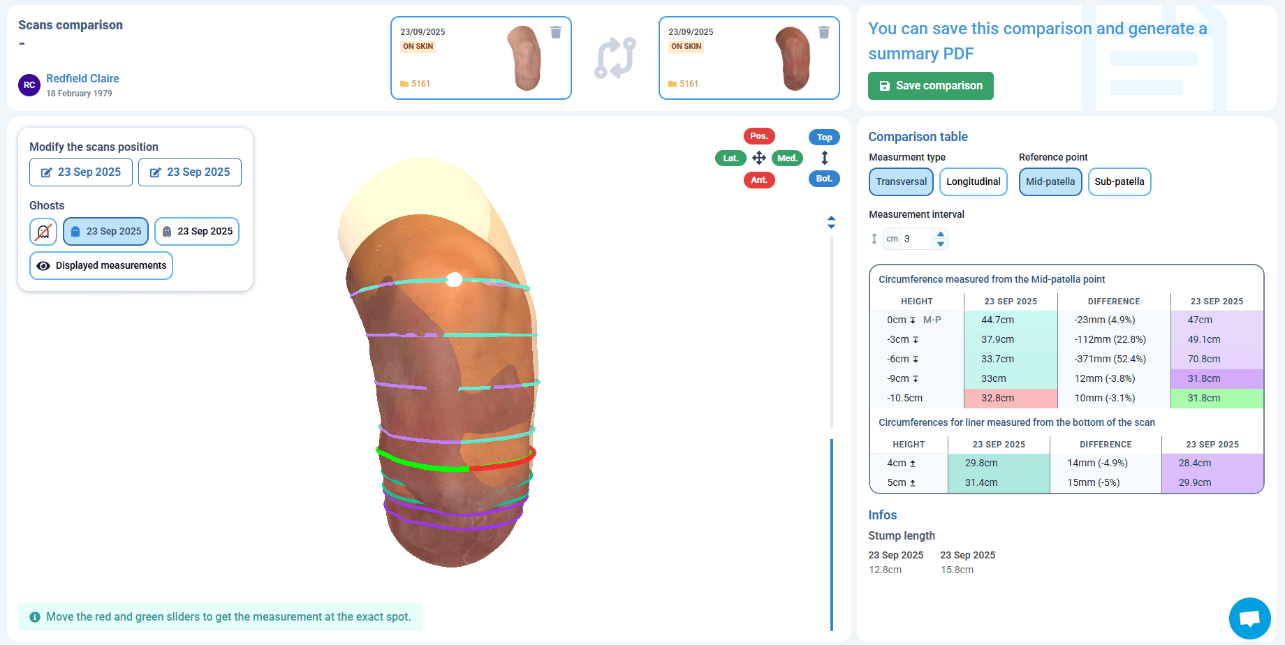Scan comparison
