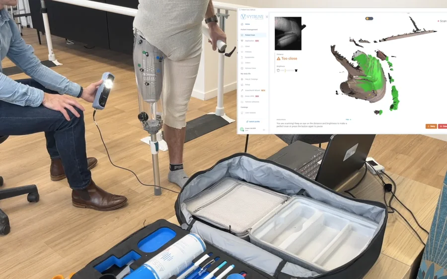Scanning a limb with the app