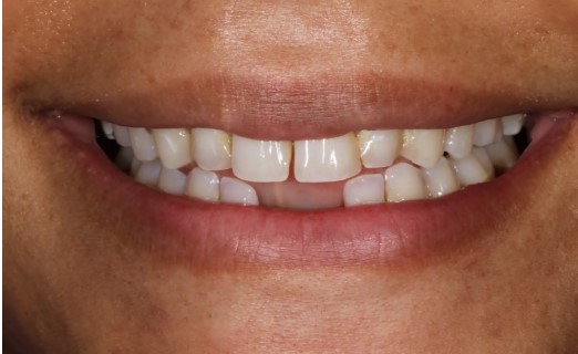 before and after treatment