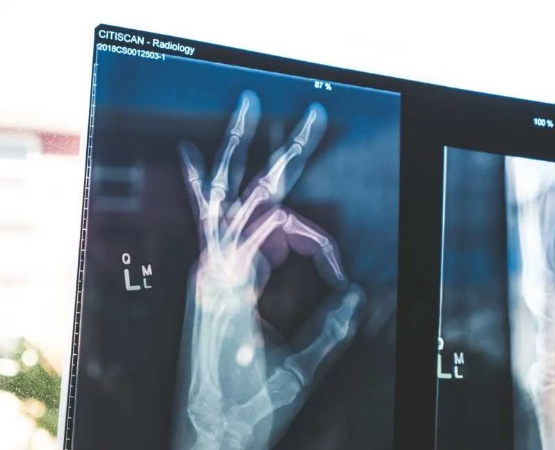 X-ray of someone pulling the 'OK' sign with their hand