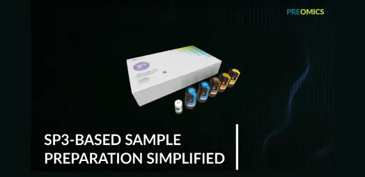 All you need to know about the SP3-iST Add-on kit
