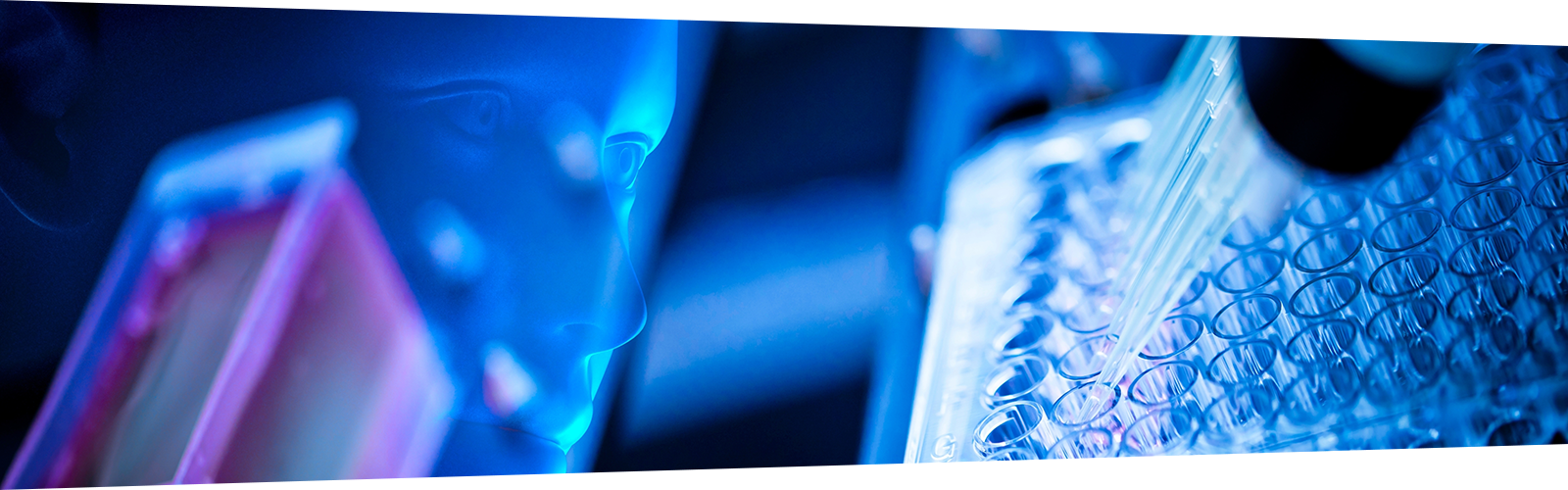 Enhancing High Throughput Sample Preparation in Bottom-Up Proteomics
