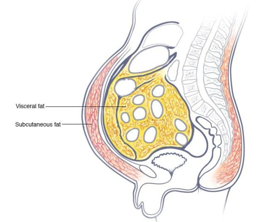 Visceral Fat vs. Subcutaneous Fat