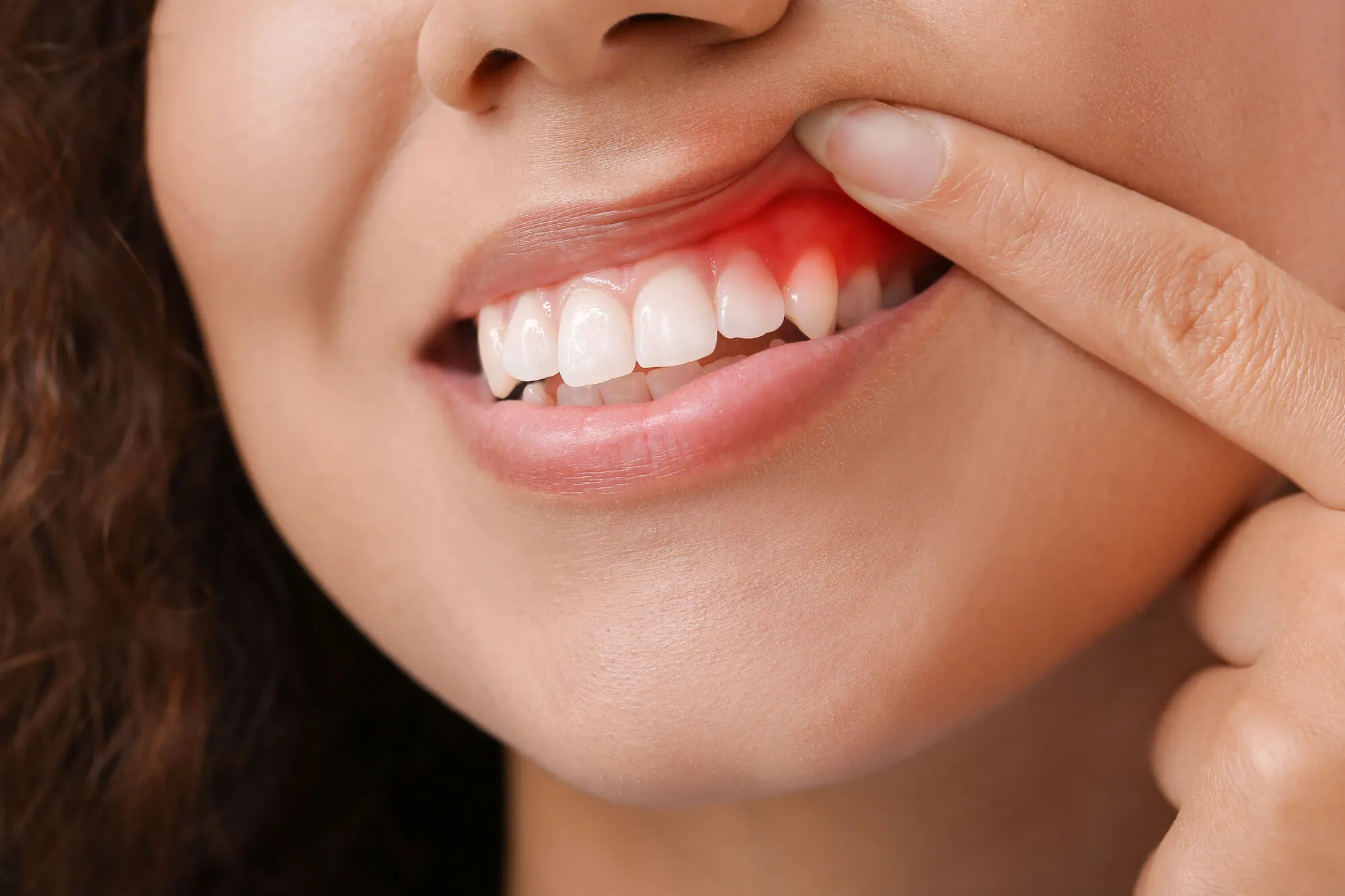 woman with swollen gums needs to see the best dentist murfreesboro tn